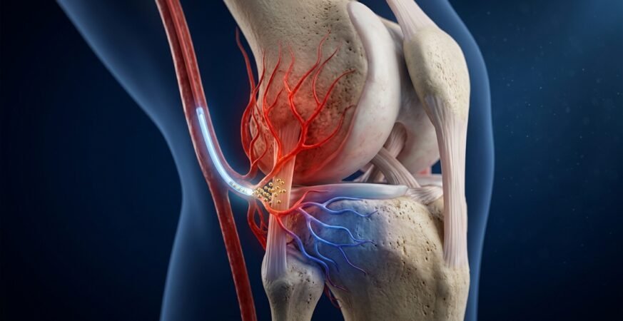 Knee_joint_medical_illustration